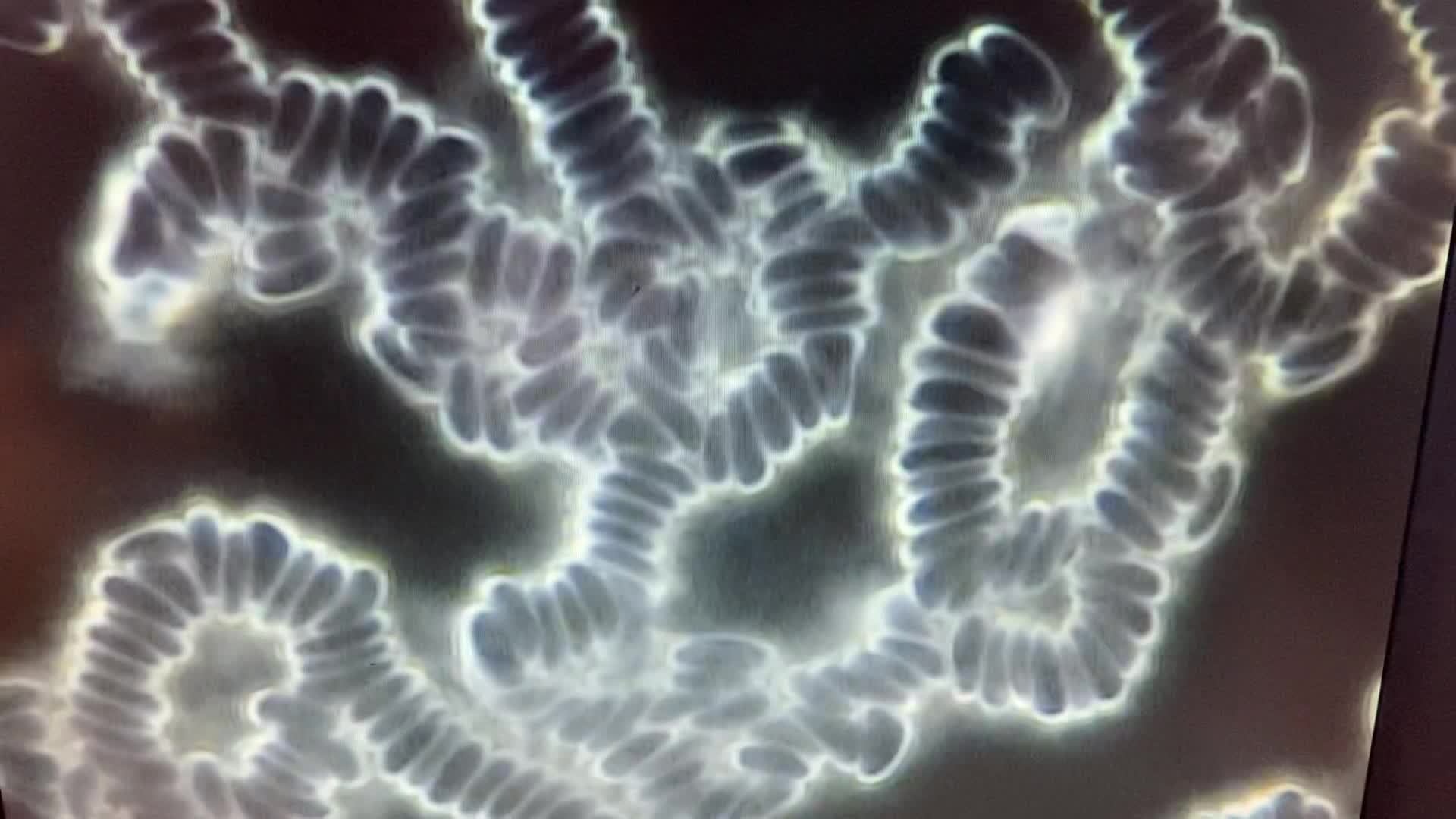 Superbe terrain ce matin en microscopie sur fond noir, ma méthode ...