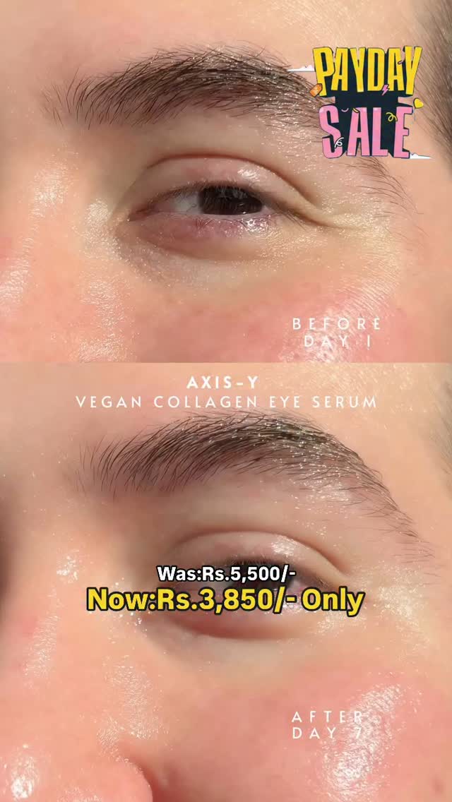 Bright eyes, no lies ✨ Axis-Y's Vegan Collagen Eye Serum is here to de-puff, hydrate & lift! www.colorshow.pk #explore #fyp #colorshowpk💕 #axisy #eyeserum