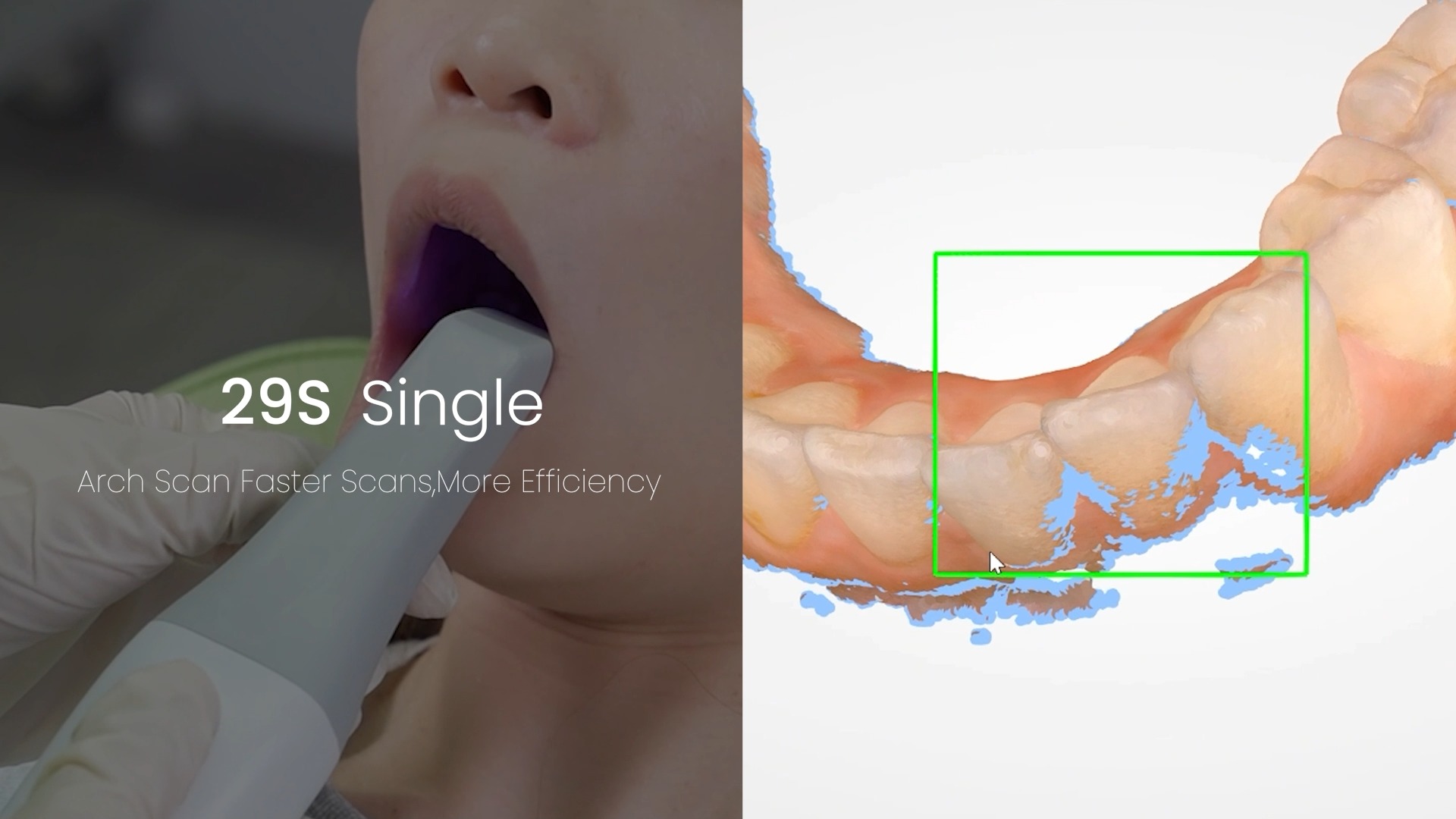 UP3D Tech - Do you work with digital dental? #UP3D #UP560 scanner is ...