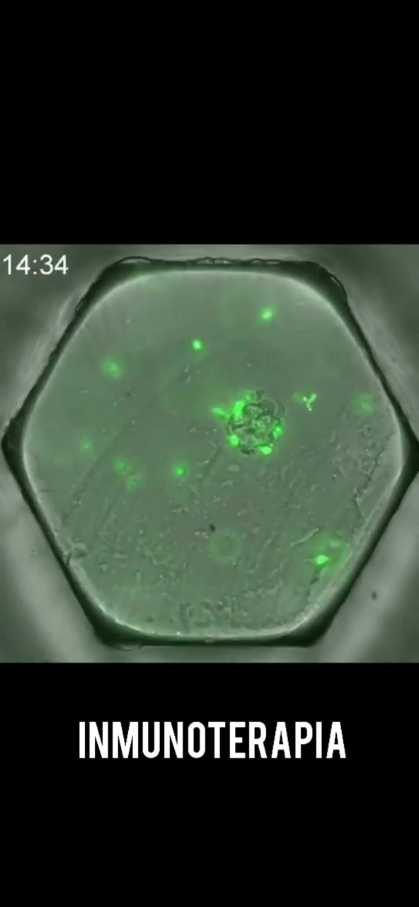 Ataque de las células T sobre las células de un tumor cancerígeno con ...