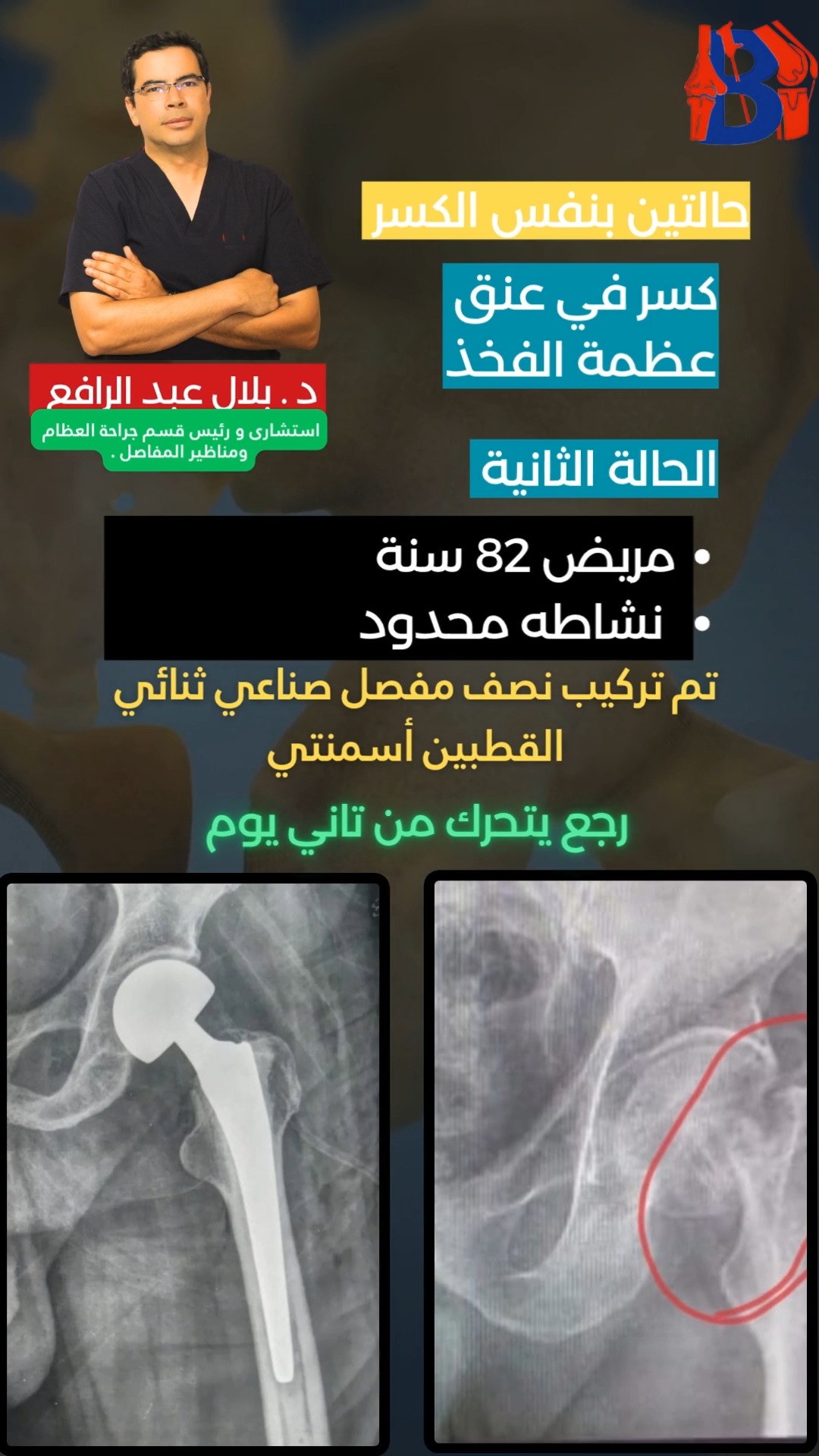 د/ بلال عبد الرافع استشاري و رئيس قسم جراحة العظام والمفاصل | Tanta