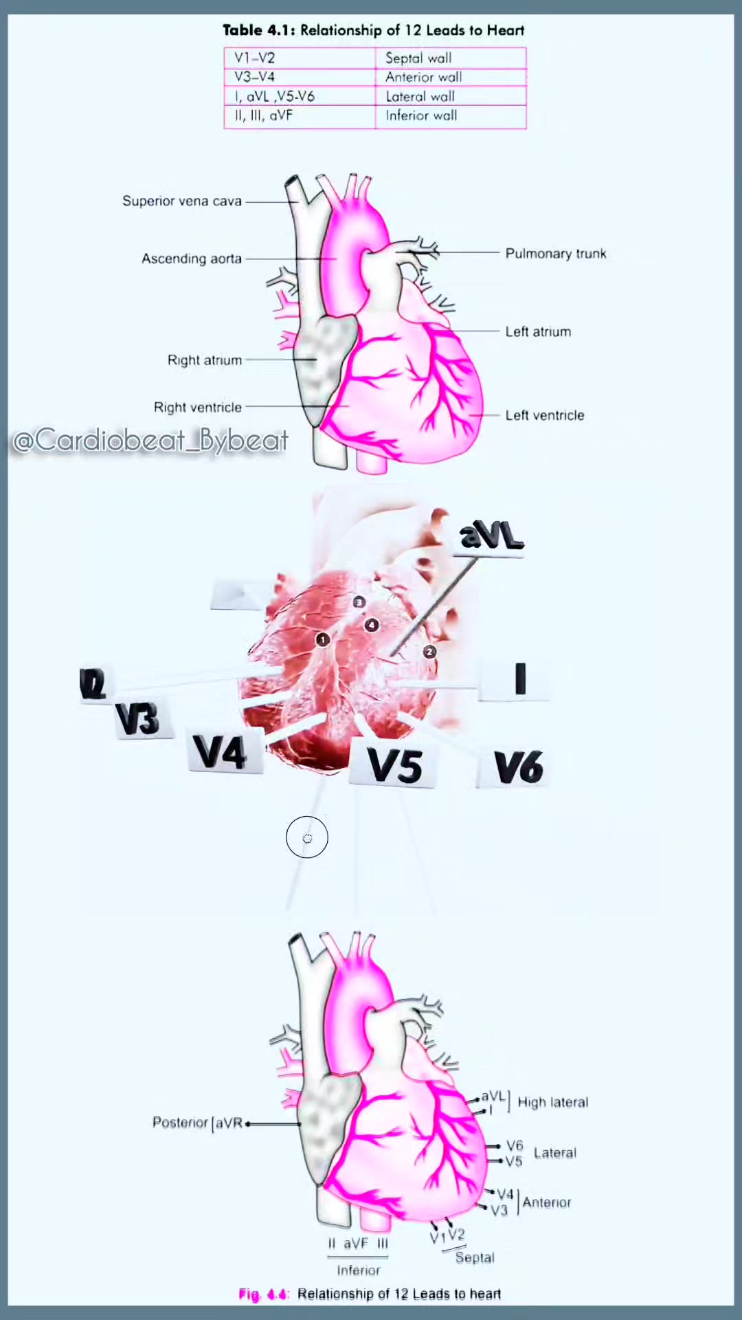 🔍 12-Lead ECG & Heart Walls 🫀 V1-V2 → Septal 🫀 V3-V4 → Anterior 🫀 I ...