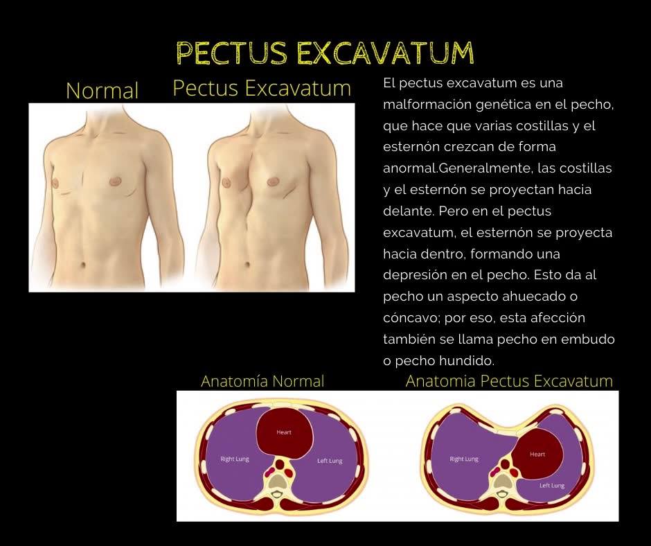 Dr. Juan Manuel Vaca Villarroel - Cardiólogo | Santa Cruz de la Sierra