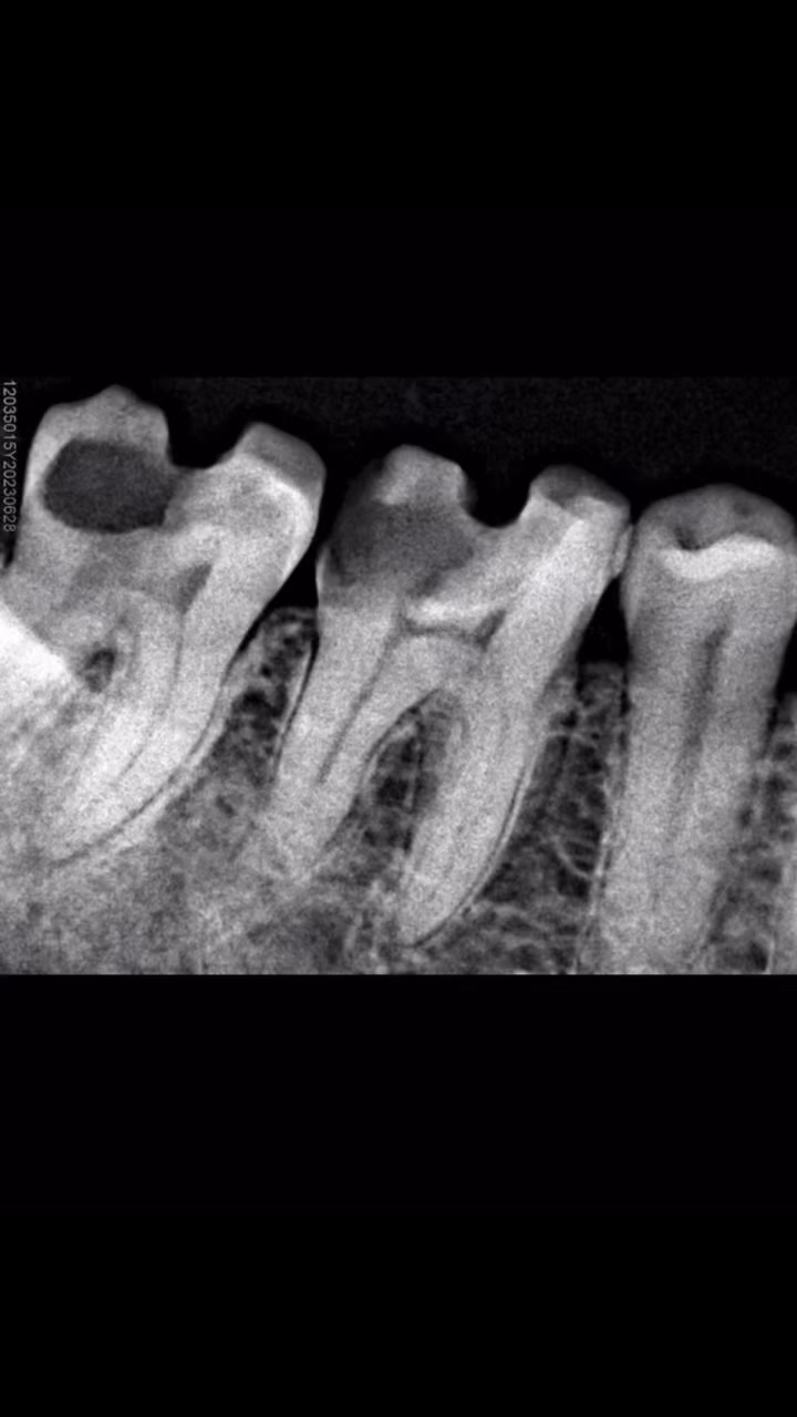 Dental Nav Smiling | Puerto Vallarta