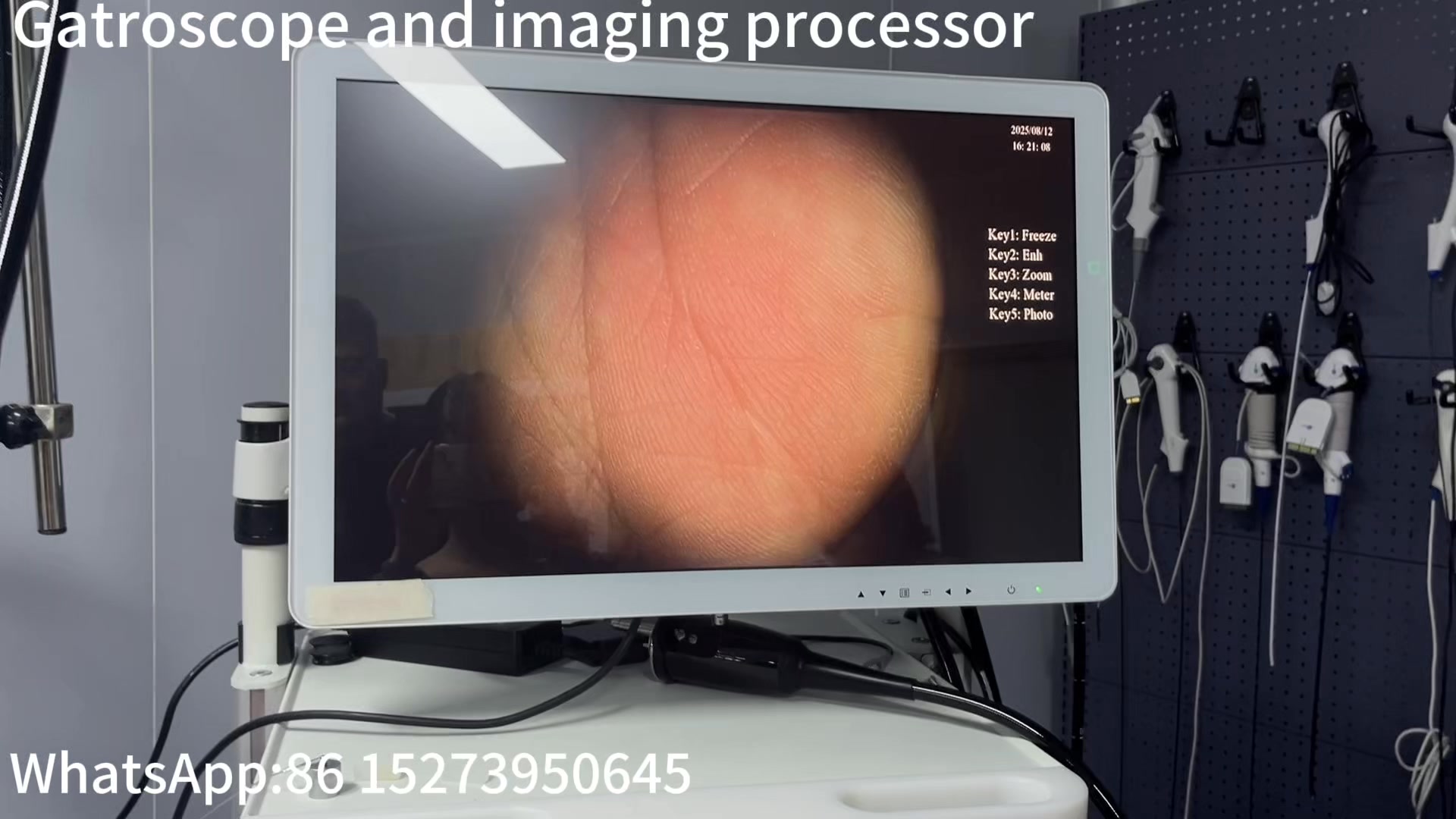 Endoscope-Farah AnchorMed | Shenzhen