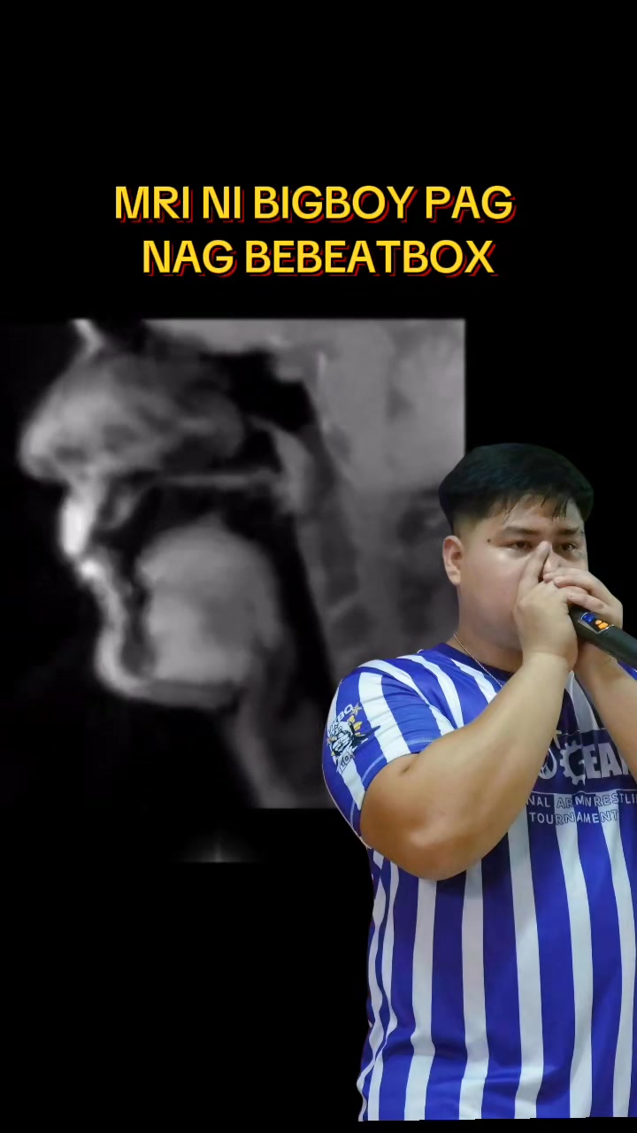 Ukbo Iloilo - Armwrestling - Videos