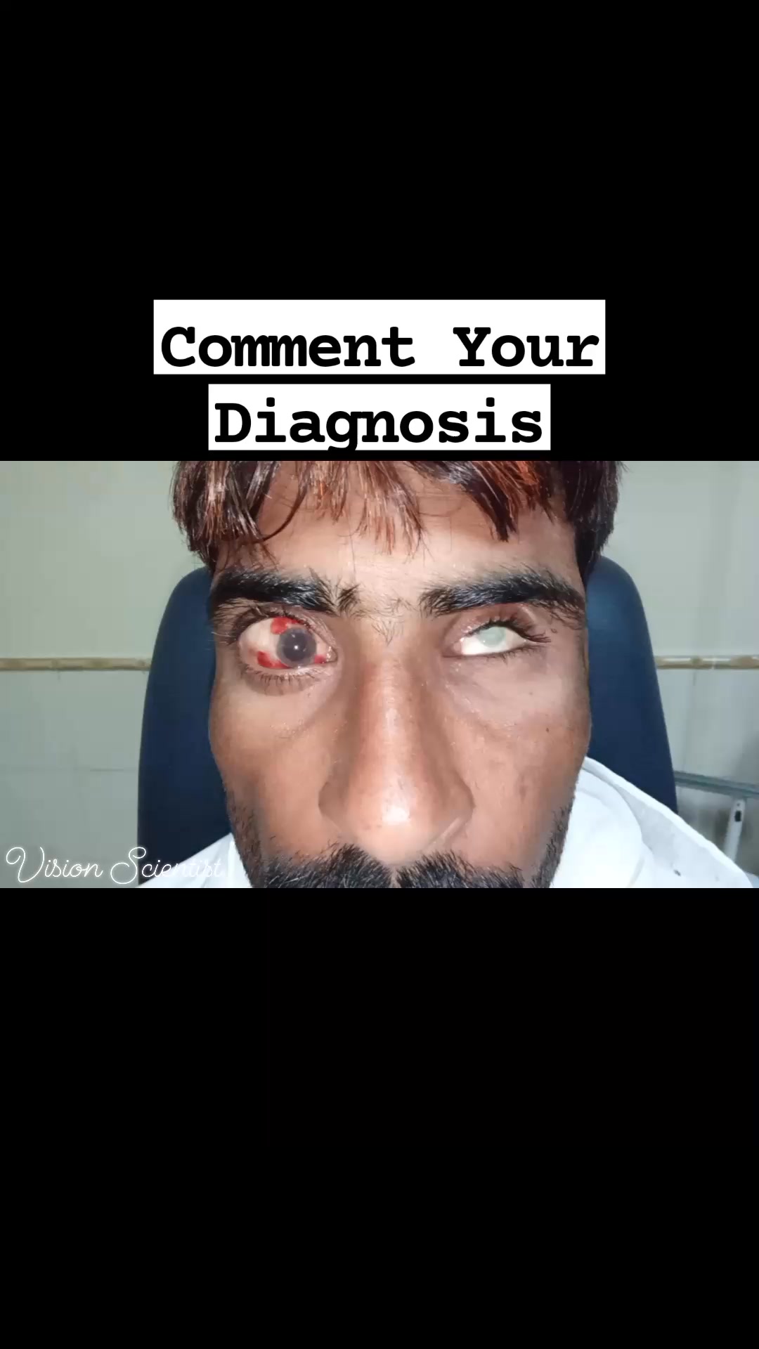 Comment your Diagnosis & Observations. Video Credit: Vision Scientist ...