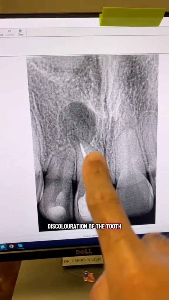 Will this retx fail because I did it in one appointment? Will it fail ...