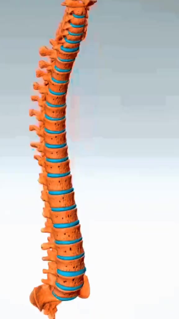 Scoliosis Correction Surgery Straightening spines, changing lives! 🦴 ...