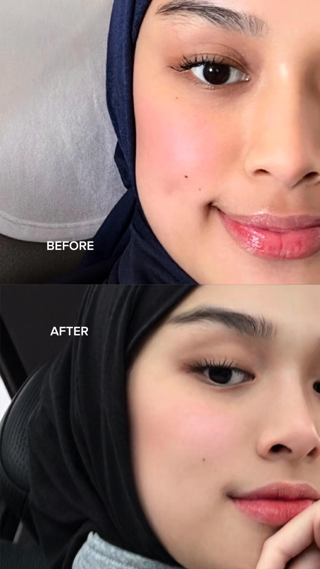 Rupanya marissa pon pakai sheet mask viral ni, patut lah makin cantik dan glowing😍 Some By Mi Sheet Mask ni lepas pakai, kulit nampak lebih cerah on the spot, rasa lembap dan