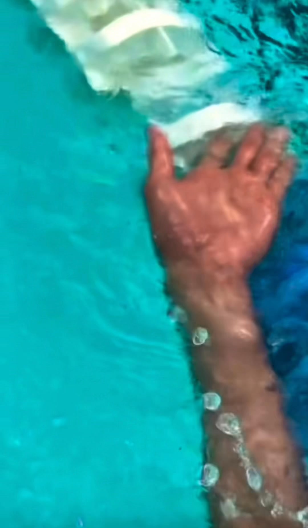 A Backstroker’s Worst Nightmare — and What to Do! 1️⃣ Hand Smacking the ...
