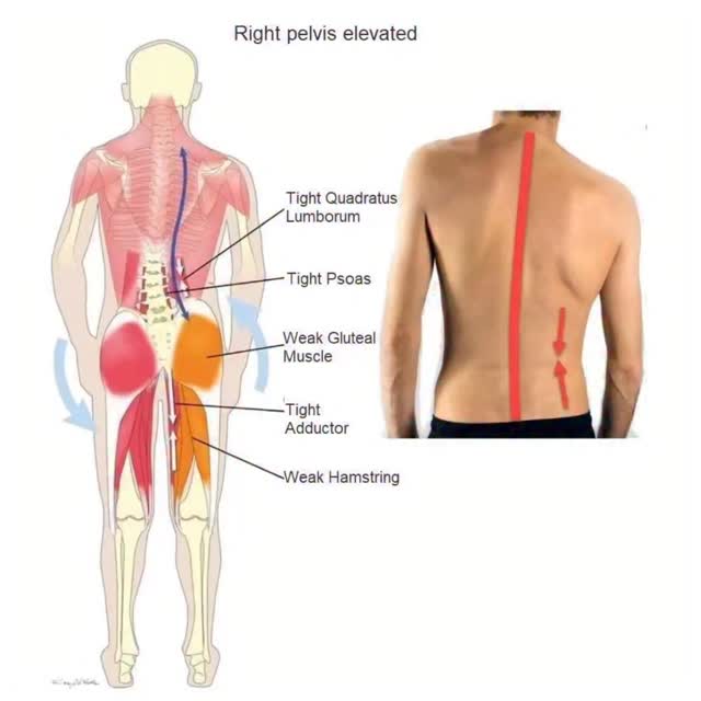 The quadratus lumborum (QL) is an... - NeuroKinetic Therapy | Facebook