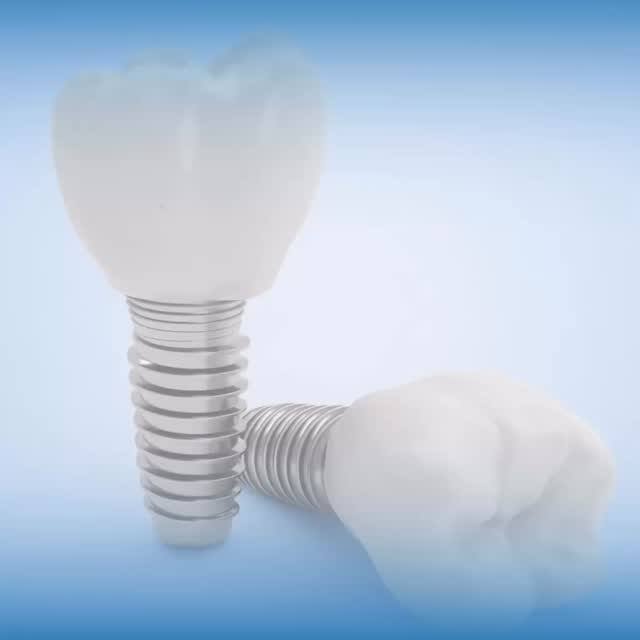 Clínica Dental Estilo 1:1 Ratio Cono de Nariz Recta Tipo-E
