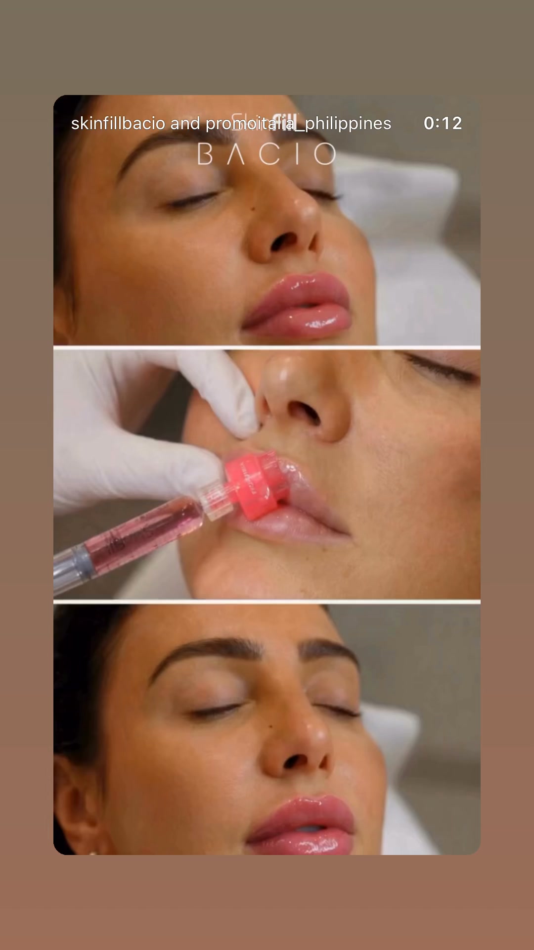 glutathione injection baguio city Whats New? , Want Mo Ba Ay HYdrated Lips❤️ Plump at pinkish Lips. woke Up Like This Kahit walang Liptint? NO Need lip Tattoo! , 💋🍓 Get Your Strawberry Lips ✨ , Say hello to naturally beautiful, glutathione injection treatment san skin whitening night cream Size:250 Tablets