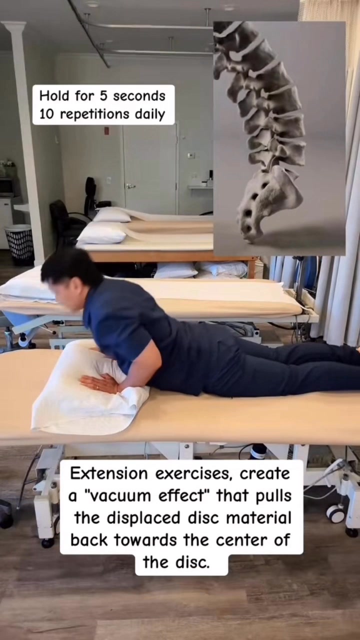 Overworked Low Back Pain Gone in Seconds. #lowbackpain #backpainrelief ...