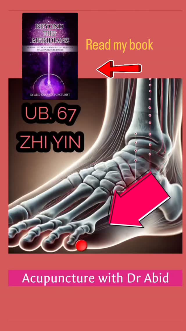 #zhiyinpoint #UB66 #acupuncturewithdrabid #acupuncture #holistichealth ...