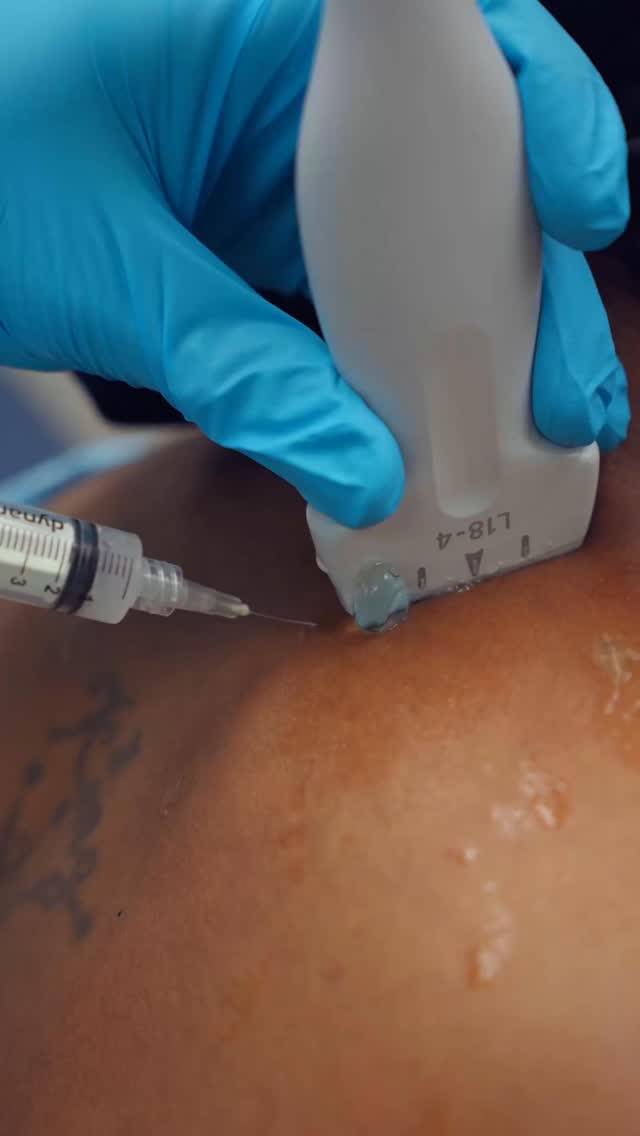 b12 injection knot Trigger point injections are used to relieve painful “knots” in the muscles of the neck and shoulders. These areas can develop from stress, poor posture, or injury, and may cause sharp or Long eyelashes are biologically biotech research Size:100X1 ml