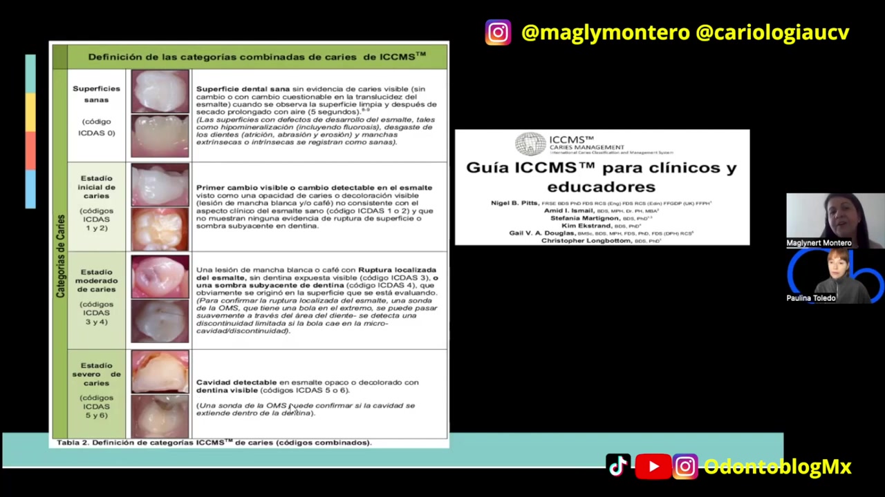 Sistema ICDAS - ICCMS 🦷 para la Clasificación de Caries Dentales ...
