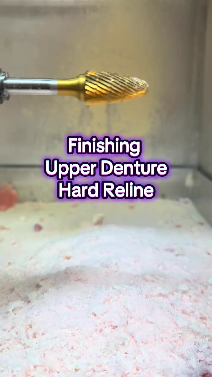A permanent hard laboratory reline is a normal part of wearing dentures ...