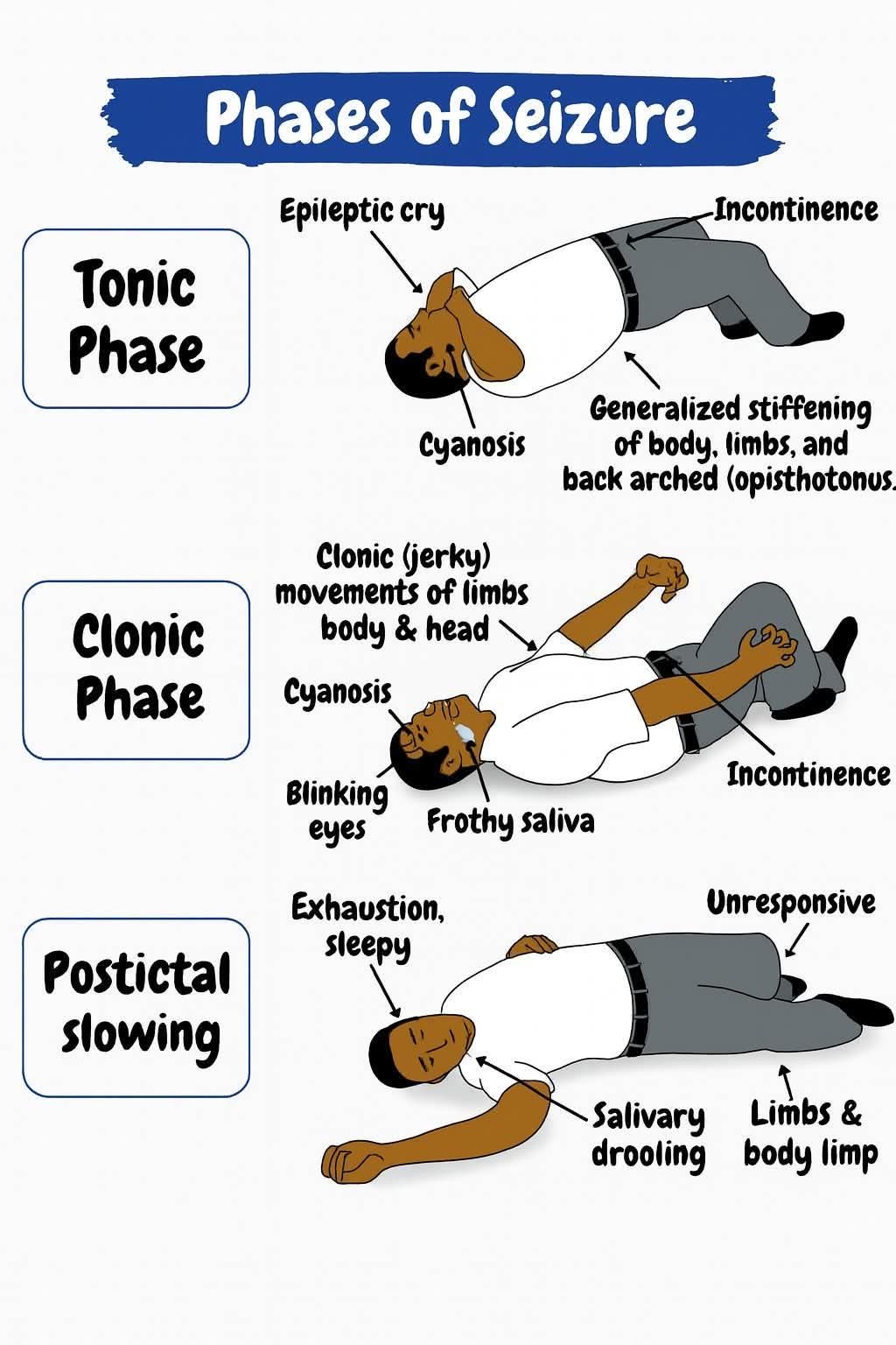 Phases of seizure | Global Emergency Medical Technicians Registry ...