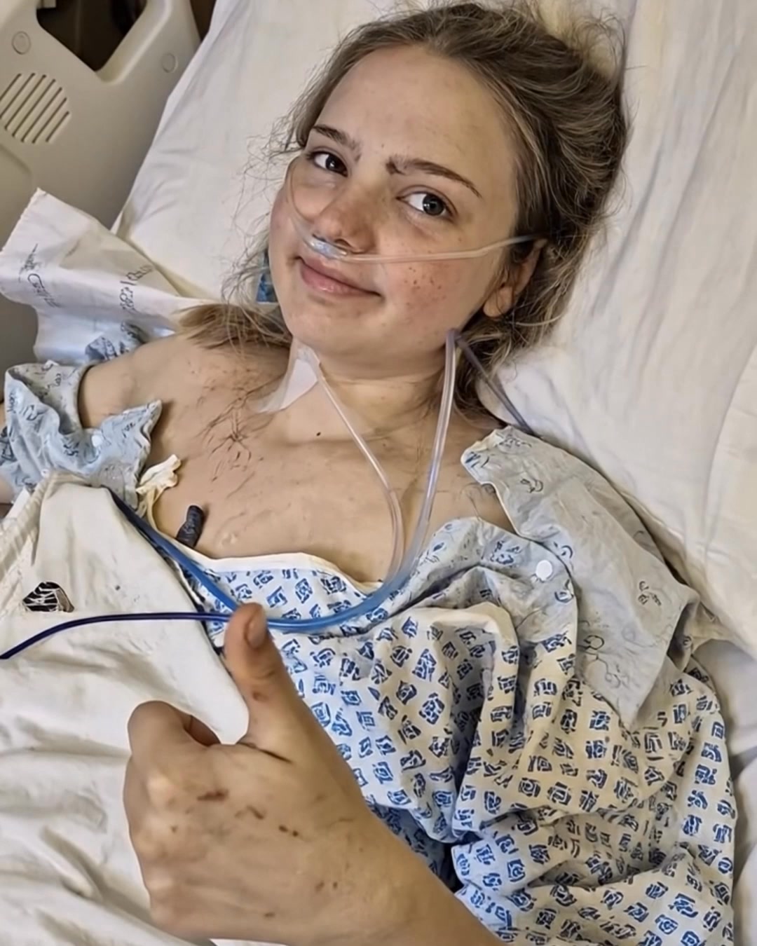 Emily was in a head-on collision while returning from the University of ...