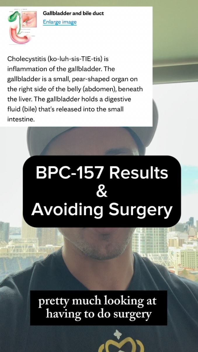 Results we weren’t expecting but were happy to see 💯, ., ., DM for Coaching💻, 👇Discount codes (Brett)👇, Peptides🧬@thetriggeredbrand, Stem Cells 🧠 @luxurystemcells , Supps🦁@alpha.lion, Gut 