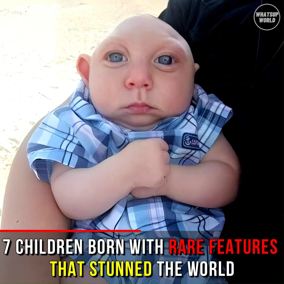 7 Children Born With Rare Features That Stunned The World | Whatsup World