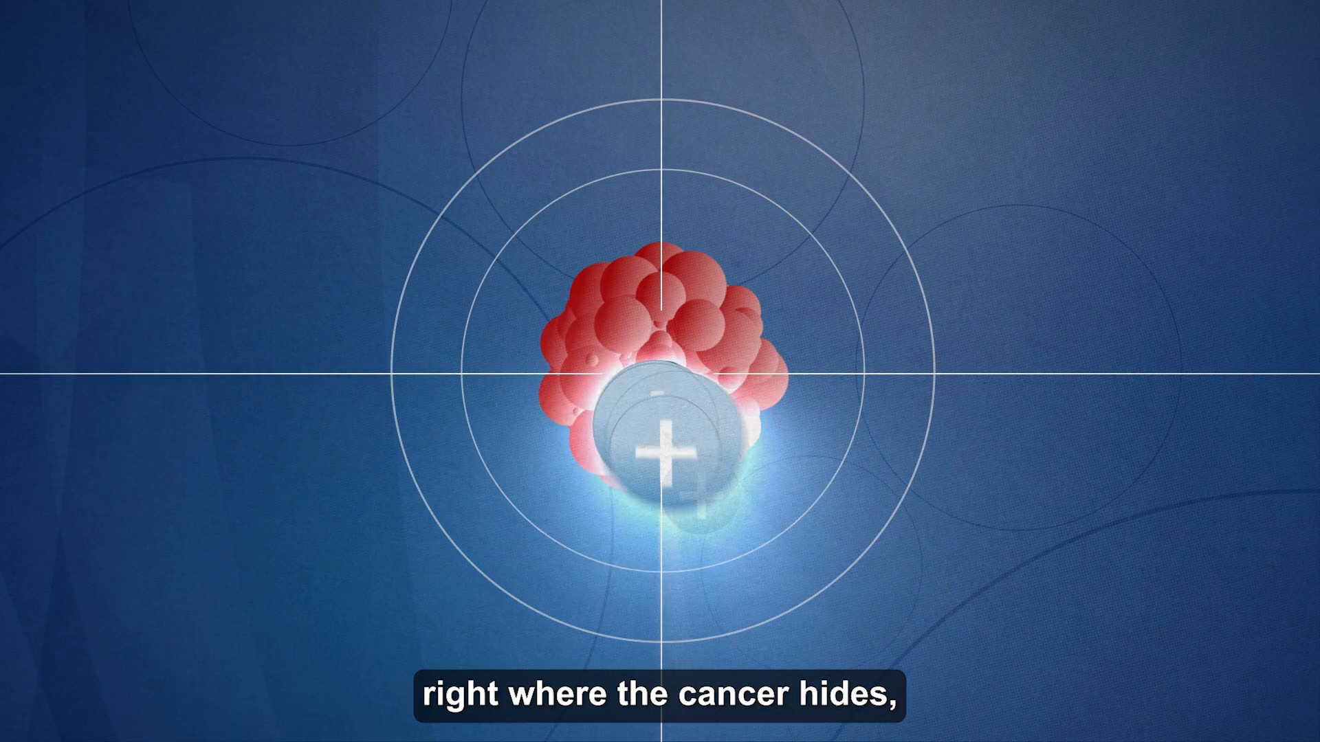 ipamorelin and cancer Proton therapy is all about precision. By delivering radiation directly to a tumor while sparing nearby healthy tissue, it helps patients get powerful treatment with fewer adverse effects. Here’s how T. Greg Doucette Threatens Size and Gauge:30 Gauge, 1 mL, 5/16-inch 11.11 Feature