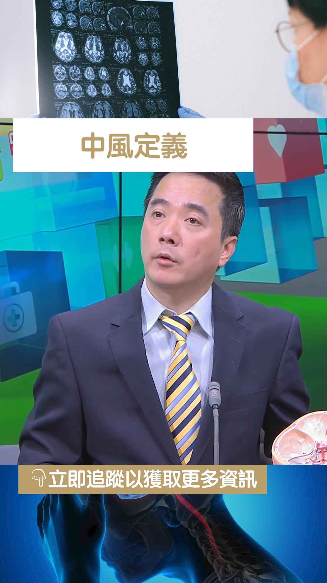 甚麼才是中風？😨照腦血管安全嗎？🤔 馬上觀看影片，搶救腦細胞的關鍵知識一次學會！ 足本版: https://youtu.be ...