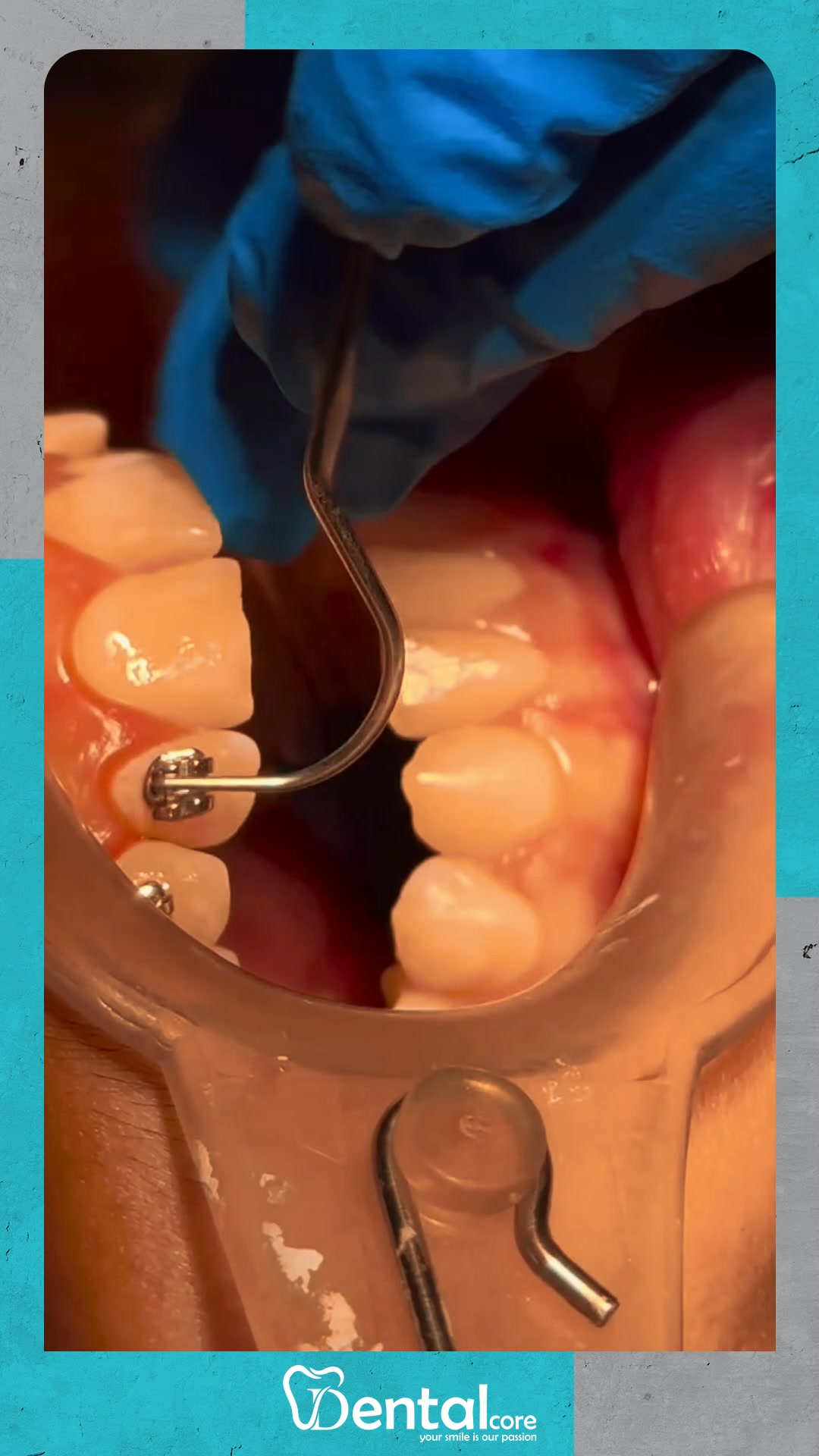 Dental Core | Cairo