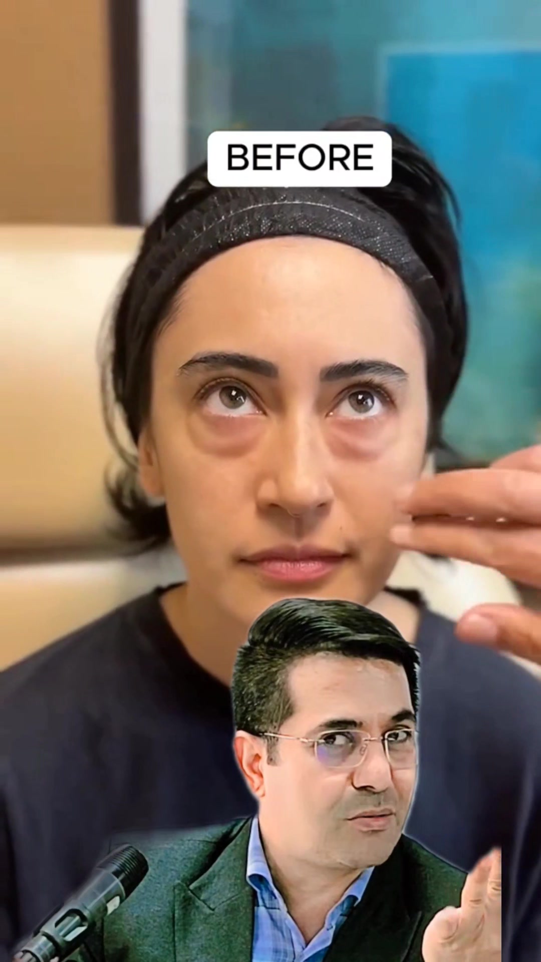 درمان آب مروارید، پف زیر چشم و افتادگی پلک با عرق رازیانه 👁️🌿 عرق ...