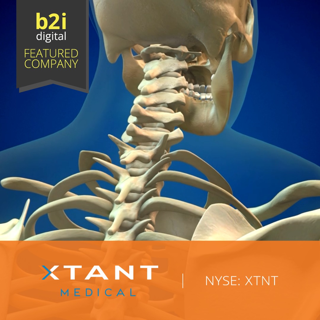 Xtant Medical Holdings (NYSE-American: XTNT) announced the commercial ...