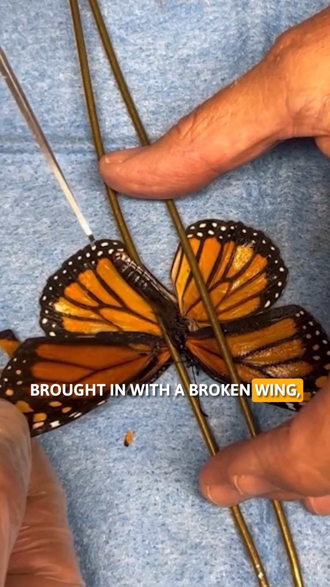 They performed life-saving surgery... on a butterfly? 🤯🦋 ️‍🩹 #Butterfly ...