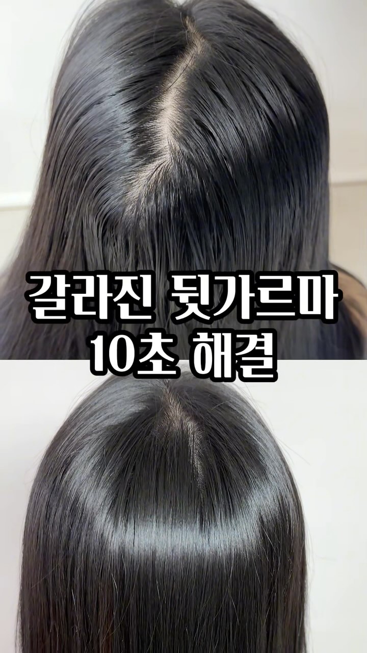 짱이지? #가발추천 #가발쇼핑몰 #여자가발 #부분가발 #정수리가발 #인모가발 #맞춤가발 #가발제작 #전체가발 #항암가발 #여성 ...