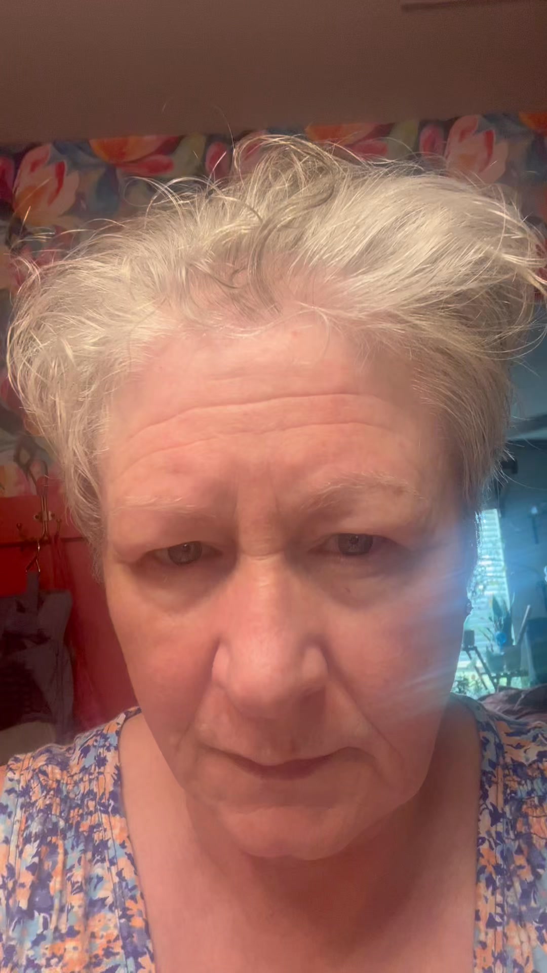 ghk-cu grey hair Gukesh Gray Nobody Told You How To