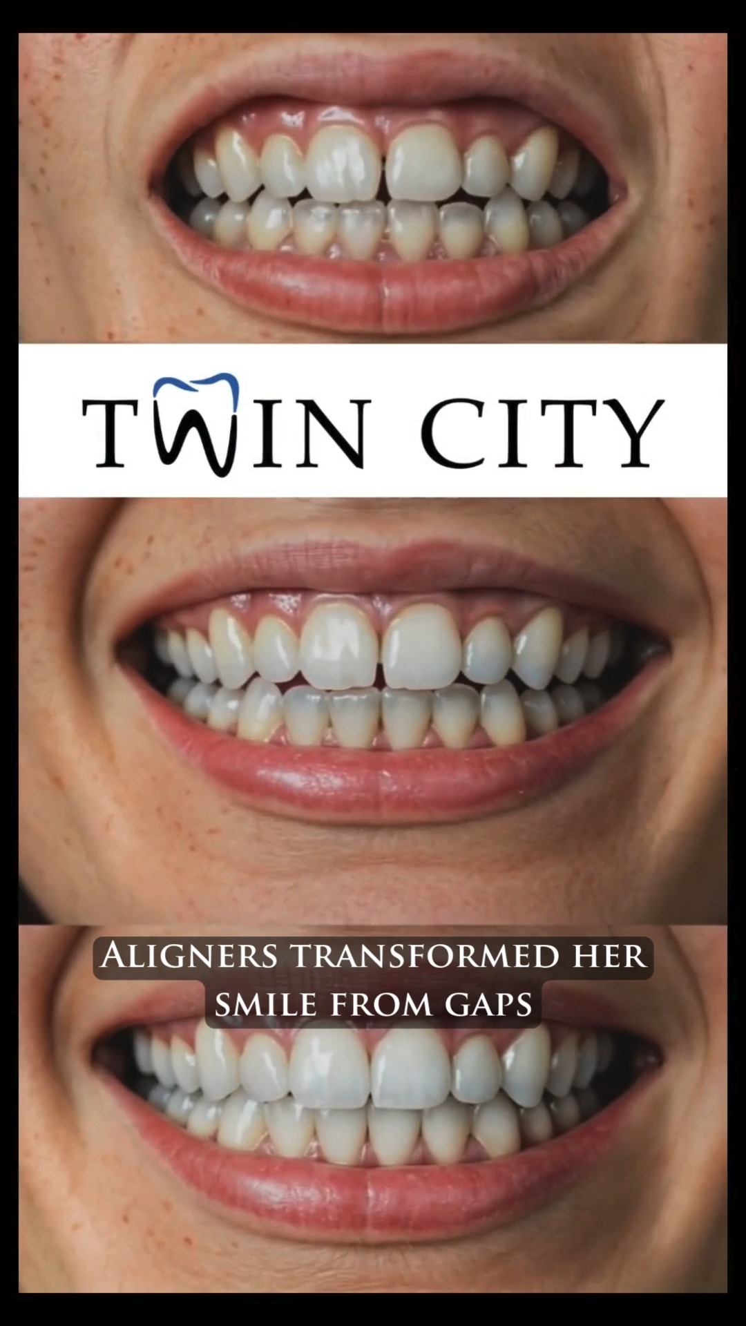 Twin City Smile | Leesville SC