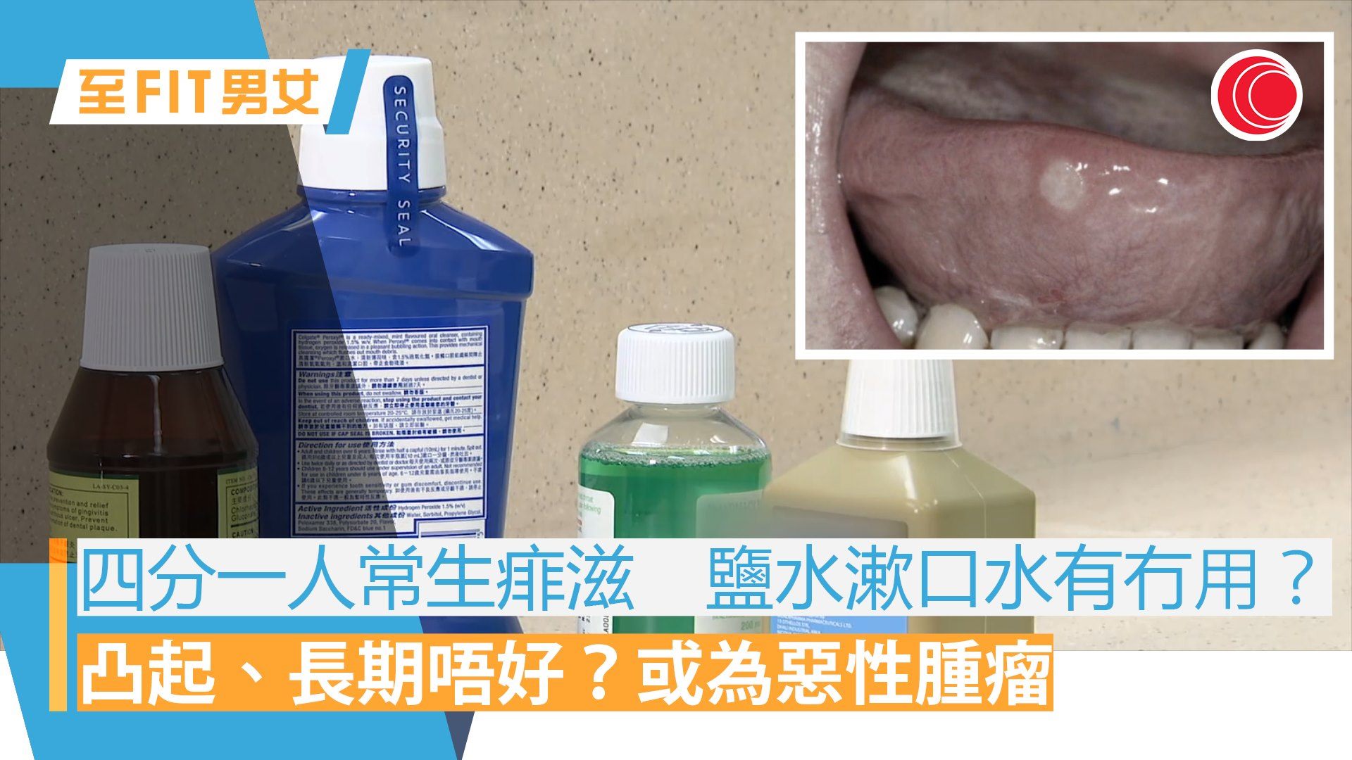【痱滋痱滋痛痛痛】生痱滋其實係免疫系統細胞作怪，要點處理？點分辨痱滋與其他疾病？等醫生話你知！ 更多至FIT男女內容： https://bit ...