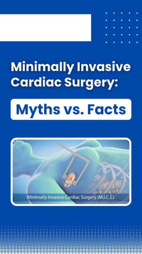 Minimal Invasive Cardiac Surgery (MICS), also known as Keyhole surgery ...