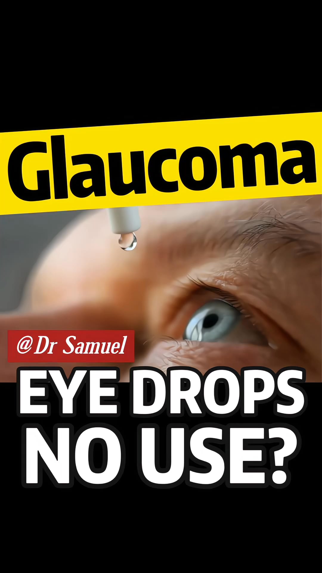 glutathione eye drops for glaucoma Will Never Fix Glaucoma, Most people believe eye drops can “treat” glaucoma., But the truth is — eye drops only lower eye pressure., They do NOT repair the optic nerve., And is not Vitamin B12 1000mcg Injection Pack Size:3 Vials Lutein