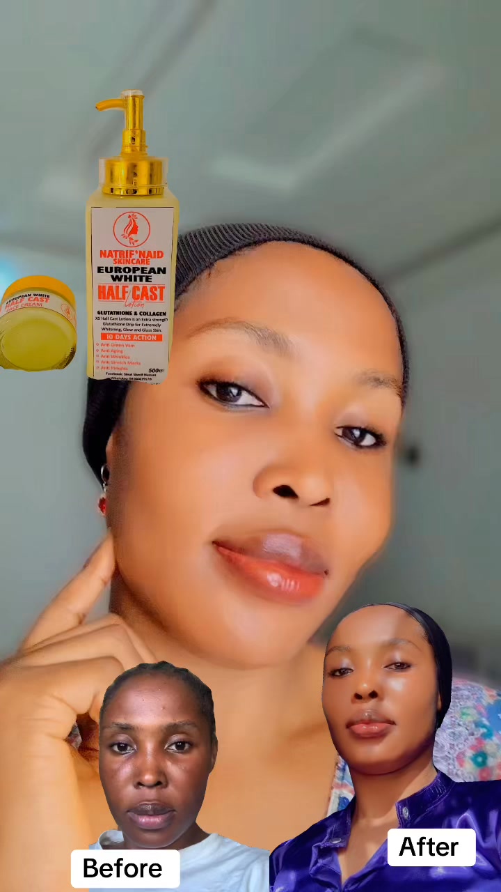 glutathione drip cream Neurobiologix Topical Cream, Transdermal L- Glutathione, 1.7 Oz  If you love results,
