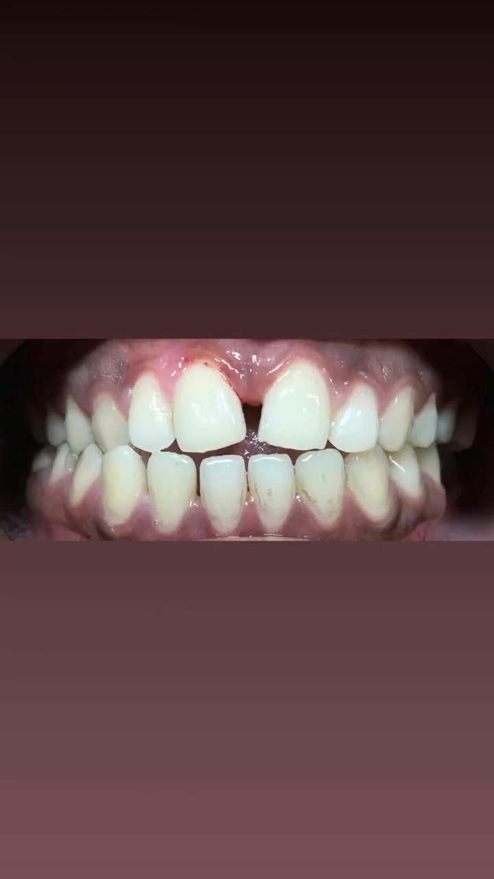 Tooth Corner Dental Care & Implant Center | Dhaka