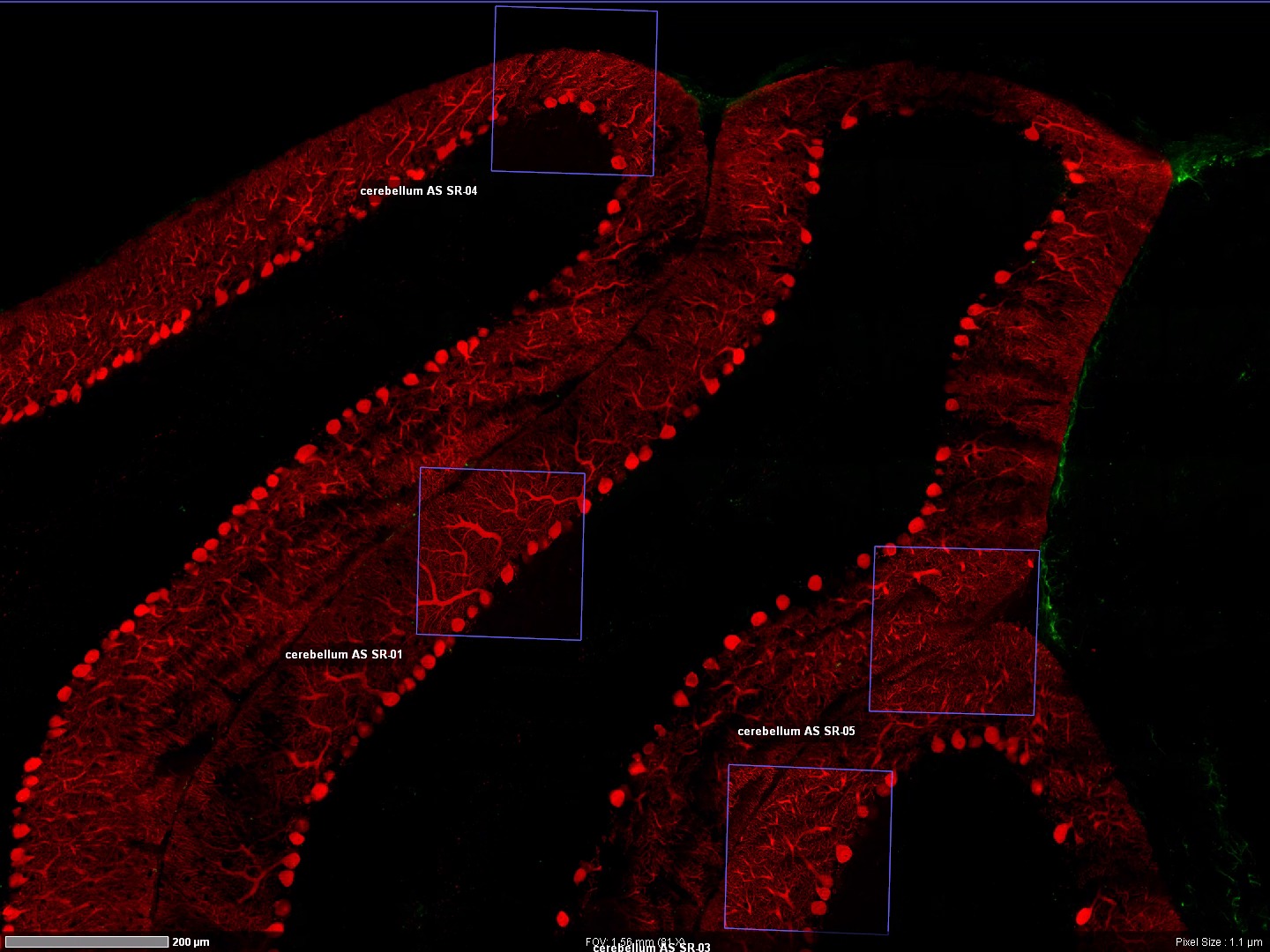 Mouse Brain Cerebellum (ZEISS LSM 980) | Multiphoton microscopy can be ...