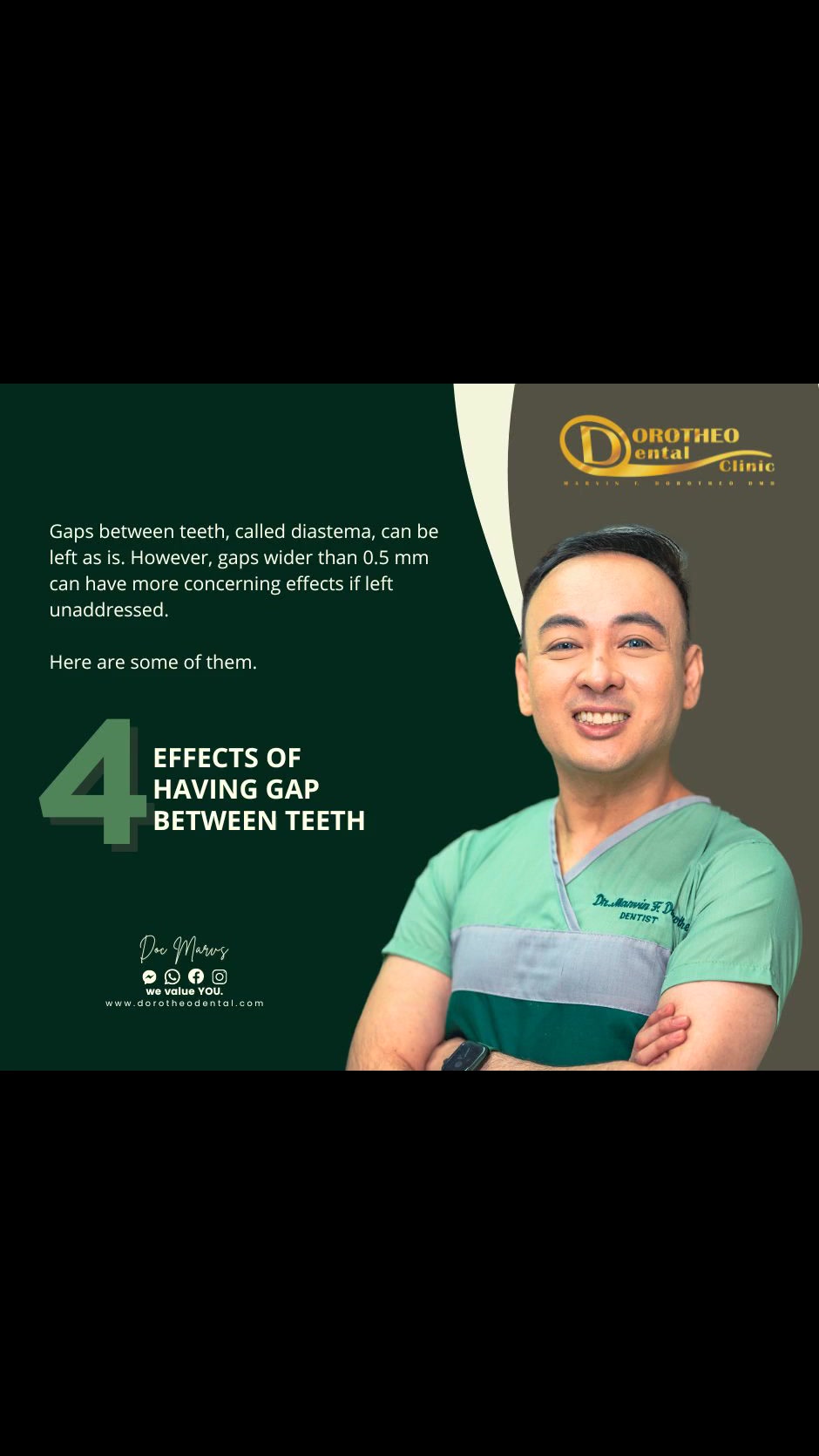 Diastema, the gap that sometimes appears between teeth, is a