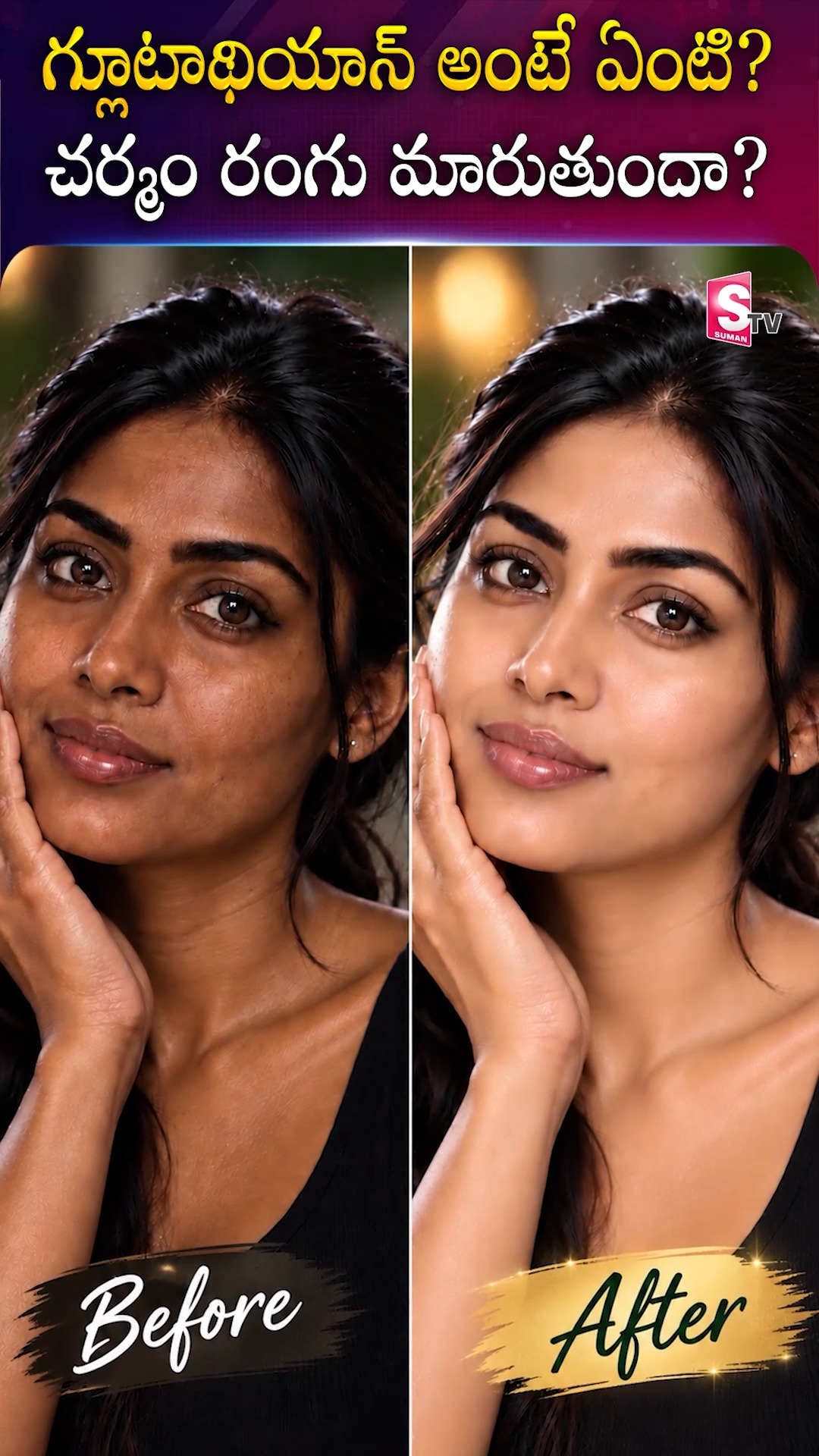 Glutathione Skin Whitening Explained: Best Face Creams Review India