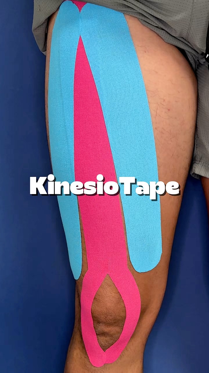 Boost quad activation with kinesiotape — a simple technique to support ...