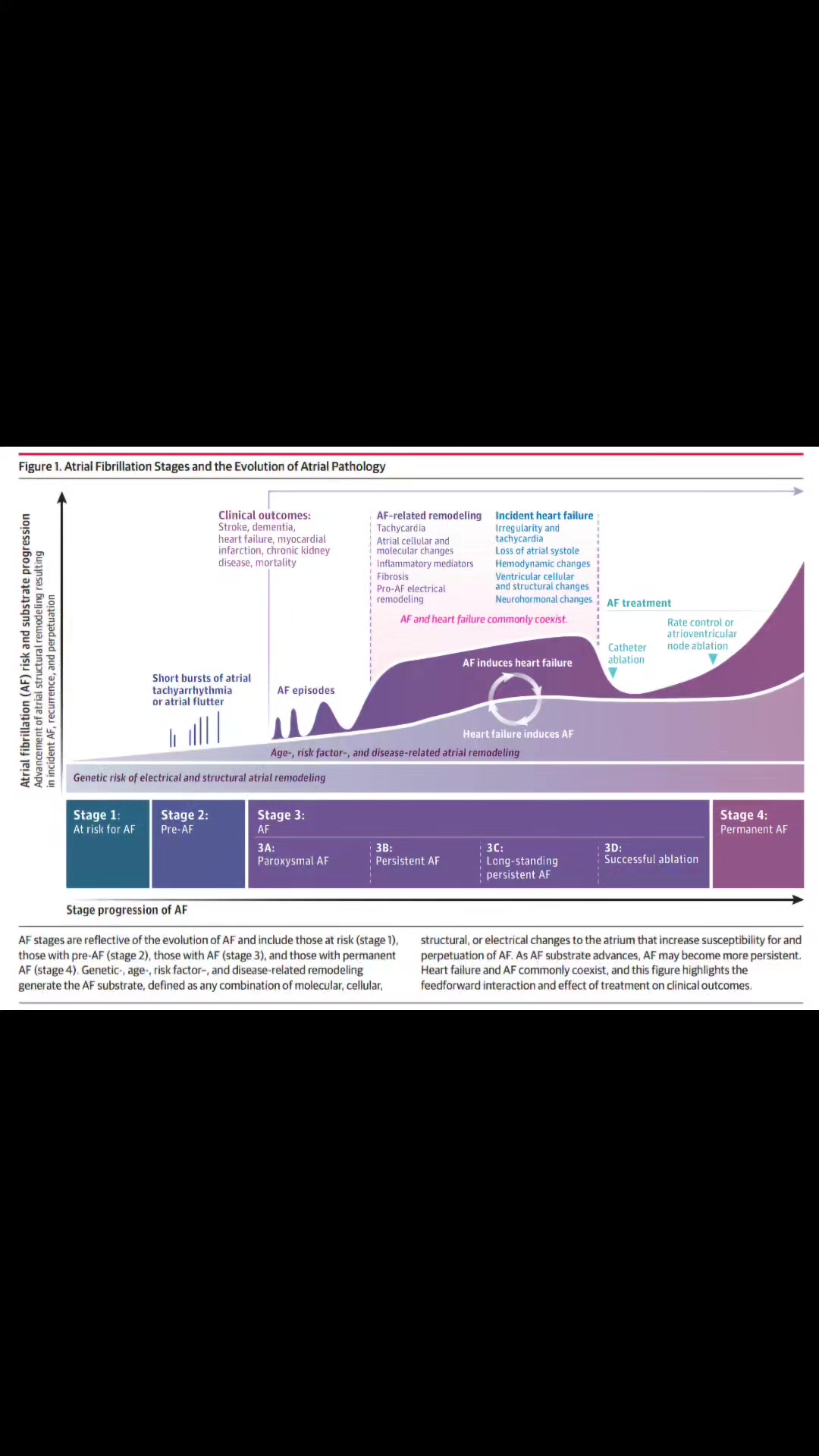 Atrial Fibrillation (AF) ยุค 2025 !! จาก Review ใหม่ล่าสุดใน JAMA สรุป ...