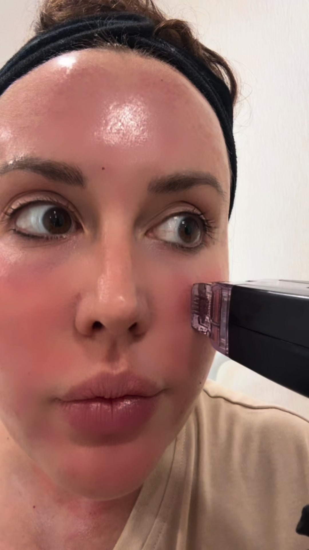 does klow help with acne ✨ Meet Peptide – your glow from the inside out. ✨ KLOW is a powerful peptide blend designed to support skin health, hair growth, and overall cellular rejuvenation. It w Buy IGF-1 LR3 AFRICA Gluton 1000 Flavor:Duo Pack (Blue Raspberry + Lemonade)