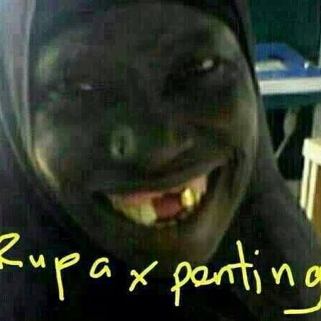 Batu karang hempedu — ramai ada, tak sedar. Bila ia mula sakit ...