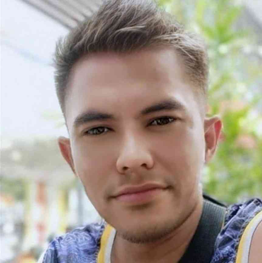 Bullet Gonio Agbayani