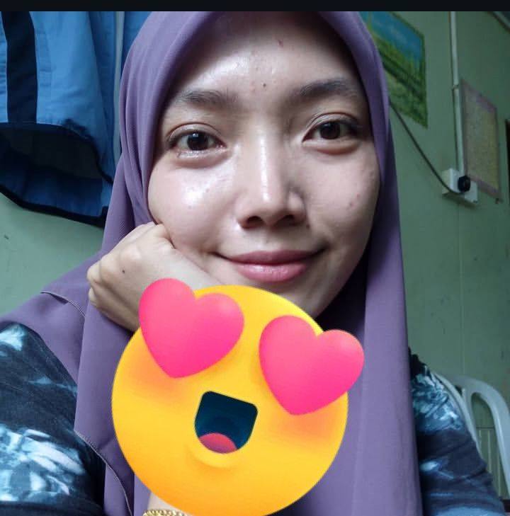 Group Ikhtiar Hamil TTC Malaysia (RASMI) | Assalamualaikum nak tnya ...